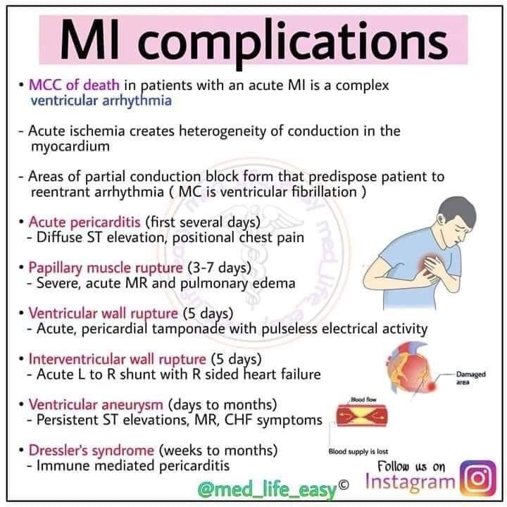 Pin by Christine Benedict on Nurse Life St elevation, Nurse life Pin by Christine Benedict on Nurse Life St elevation, Nurse life