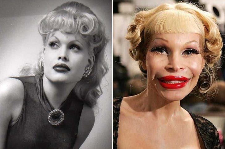 Celebridades Que Fueron Impresionantes Pero No Envejecieron Agraciadamente Wtfacts Cirugía Plástica Famosos Cabello Rizado Con Plancha Celebridades