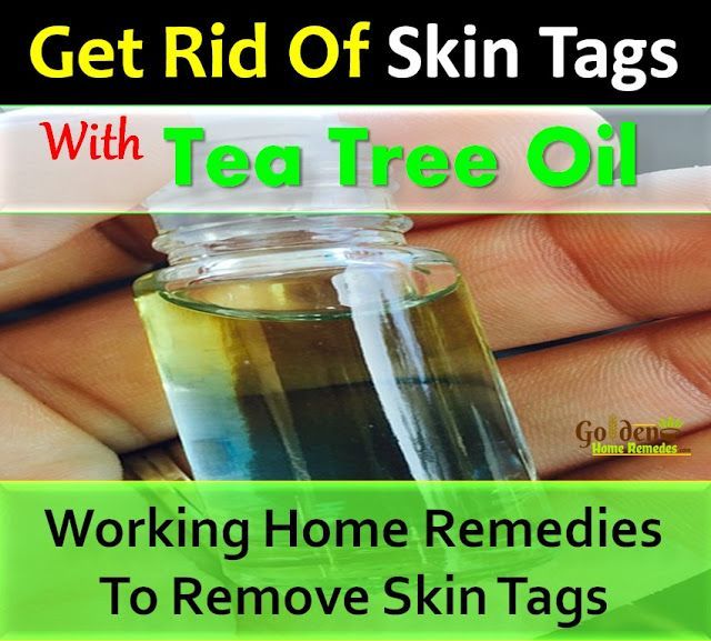 Yeast infection tea tree oil