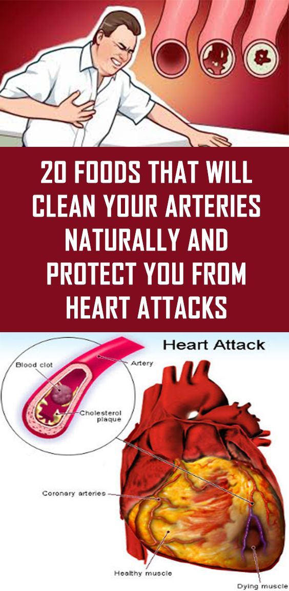 20 Foods That Will Clean Your Arteries Naturally and Protect You From 20 Foods That Will Clean Your Arteries Naturally and Protect You From