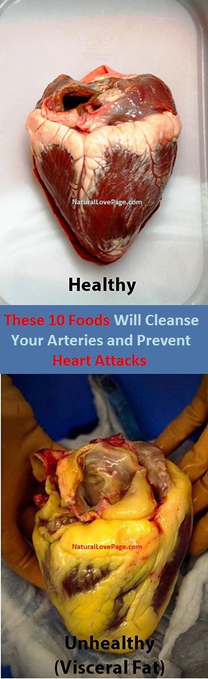 Healthy Food For Heart Blockage Patient Healthy Food For Heart Blockage Patient
