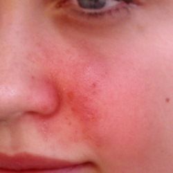 Femdom tiny cock nurse Spank me hard and call me