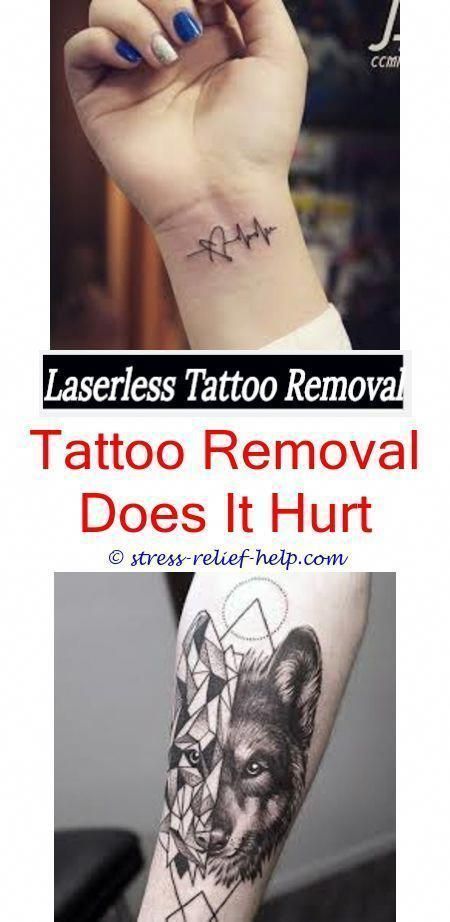 laser tattoo removal clinic what happens to skin during laser tattoo removal - t..., #clinic...