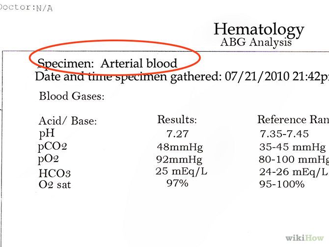 93 best phlebotomy images on Pinterest Nursing students, Student - sample lab report 93 best phlebotomy images on Pinterest Nursing students, Student - sample lab report