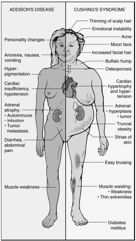 Addison S Disease Vs Cushing S In Dogs Addison S Disease Vs Cushing S In Dogs