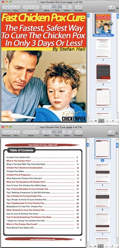 Fast Chicken Pox Cure Ebook