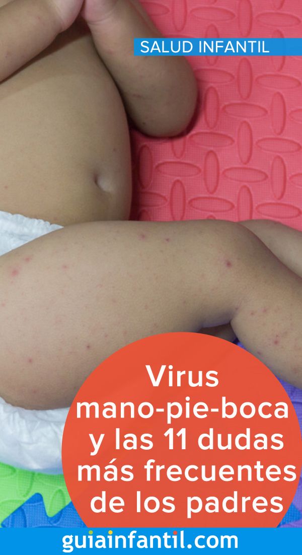 Pin En Salud De Bebés Y Niños