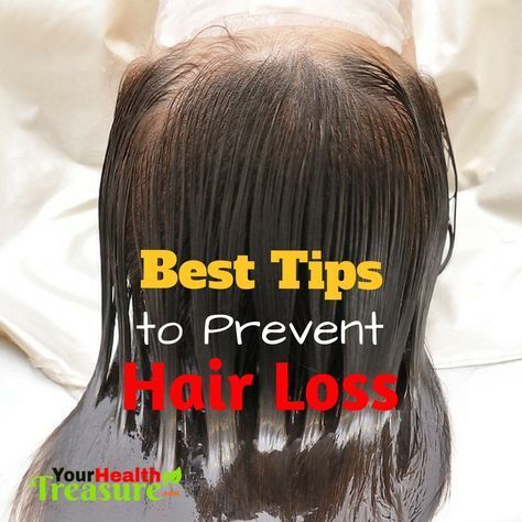 How To Stop Hair Fall Naturally For Mens How To Stop Hair Fall Naturally For Mens