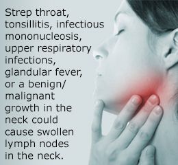 swollen lymph nodes hiv