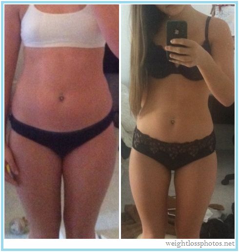leg fat loss before and after