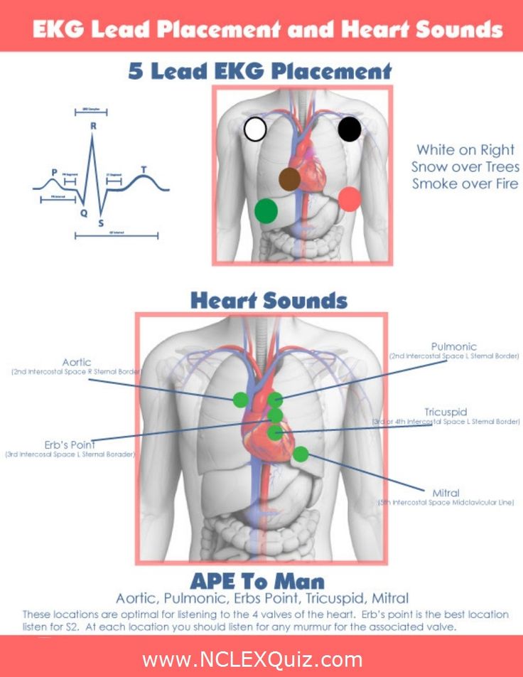 pediatric lead placement diagram 50 best acls images on health 21 day fix pediatric lead placement diagram 50 best acls images on health 21 day fix
