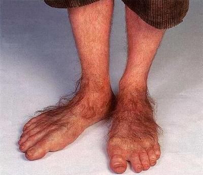 FEET: pretty or repulsive? 37a7df1e04d99b5282f3fd9b83a575c4--hobbit-feet-facial-hair