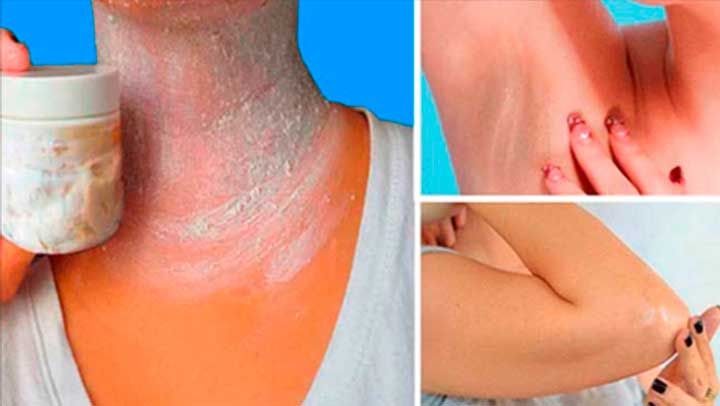 Pin en belleza Como Sacar La Tintura Negra De La Piel