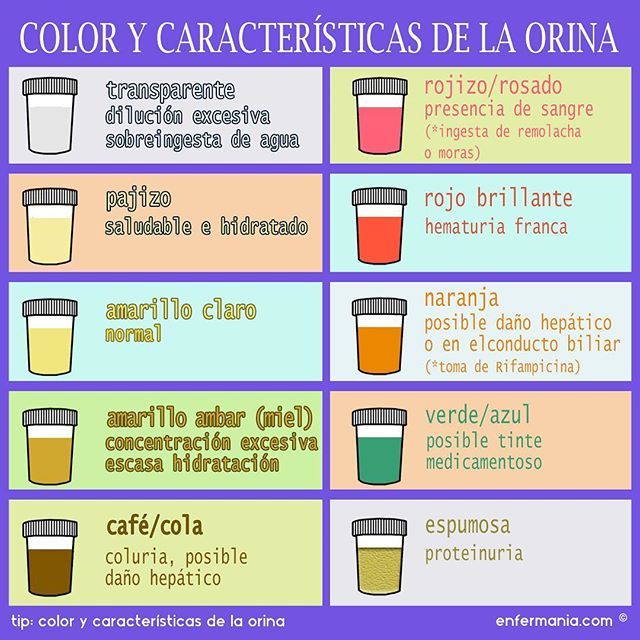 de que color tiene que ser la orina normal
