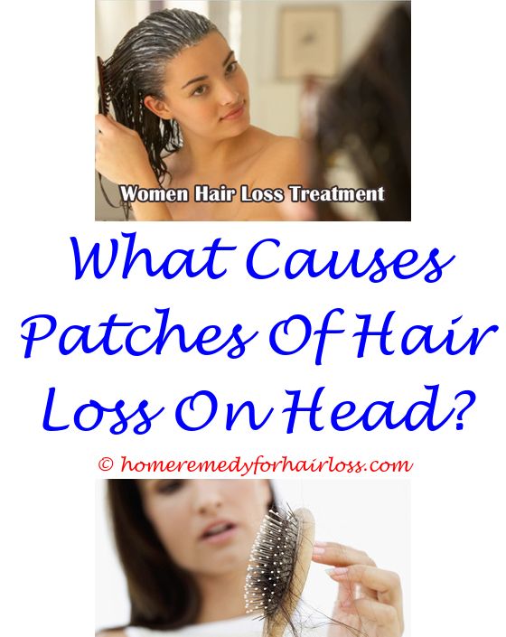 14 best Vitamin D Hair Loss images on Pinterest