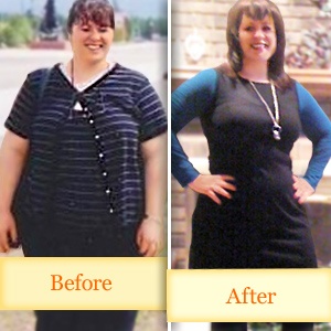 How much does achieve medical weight loss cost image 2