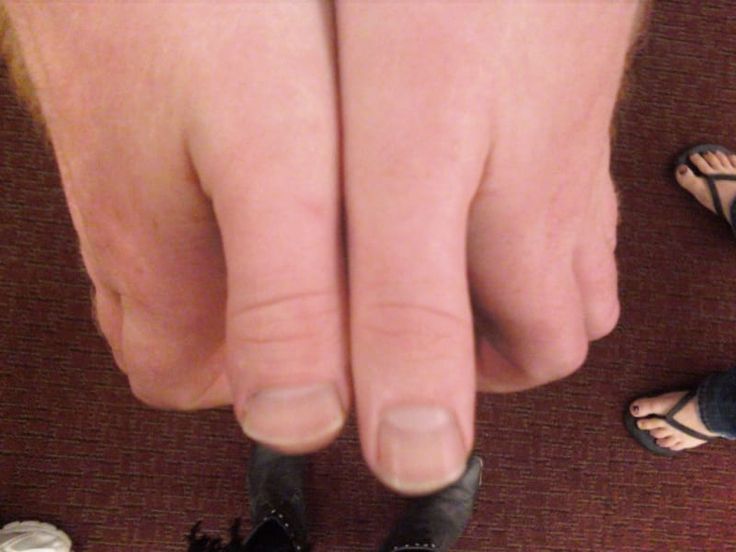toe thumbs toe thumbs