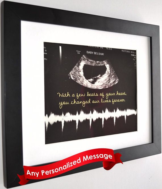 29 Best Nursery Ideas Images On Pinterest Baby Room Child Baby Nursery Décor Shower Boy Gift For Hartem Decor Unique