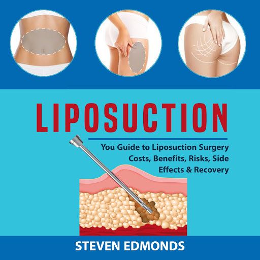 Liposuction: You Guide to Liposuction Surgery Costs, Benefits, Risks, Side Effec...