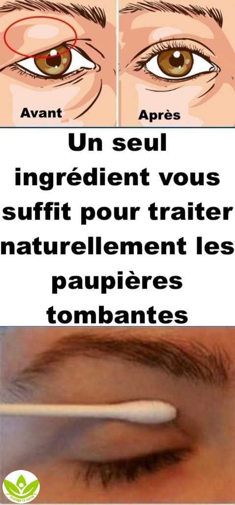 Un seul ingrédient vous suffit pour traiter naturellement les paupières tombantes! Les résultats vous seront visibles en 2 minutes seulement!!
