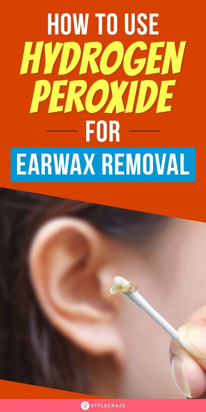 ear wax removal hydrogen peroxide ear wax removal hydrogen peroxide