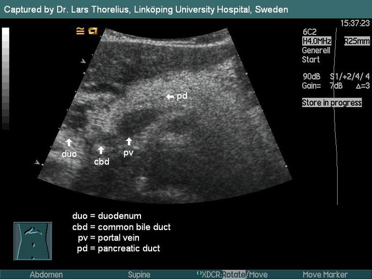 Pin on Pancreas
