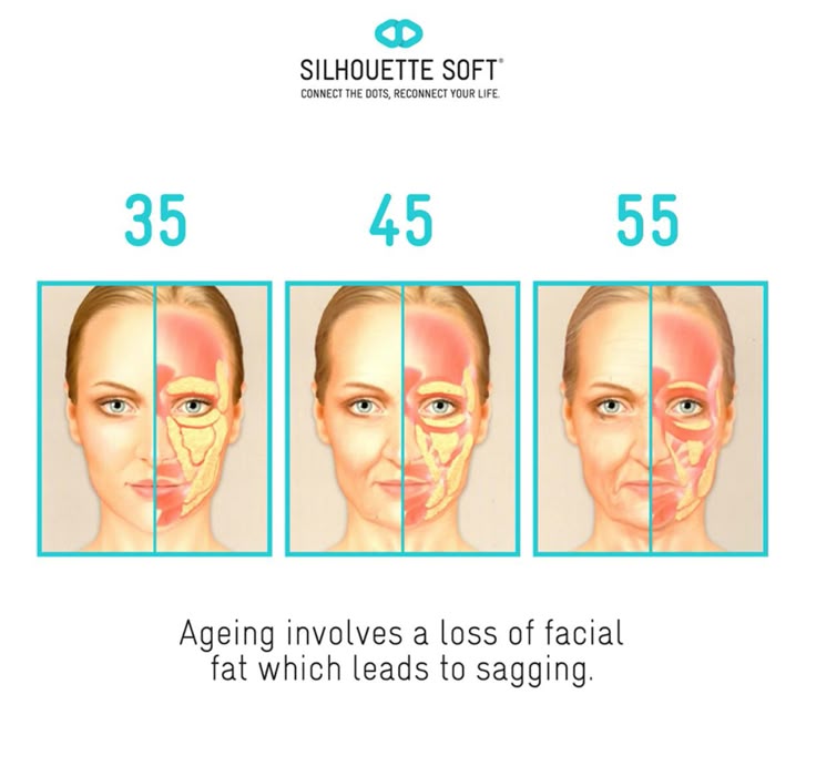 parohia st blaise elvetia anti aging