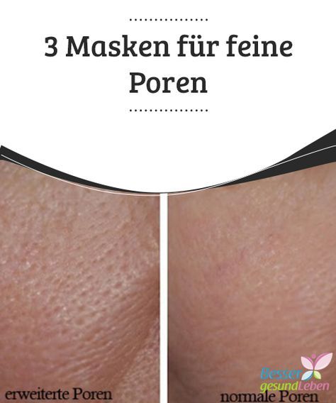 3 Masken gegen vergrößerte Poren – beauty 3 Masken gegen vergrößerte Poren – beauty
