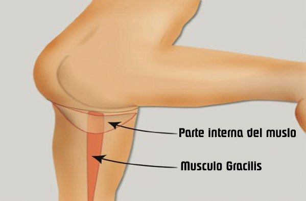 dolor lado interna muslo