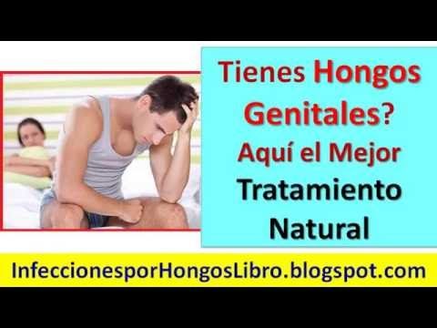 Cómo combatir las infecciones por hongos naturalmente Cómo combatir las infecciones por hongos naturalmente