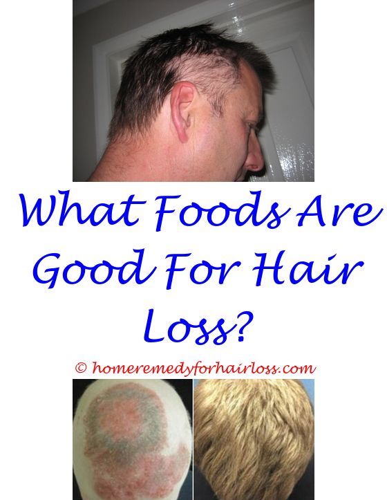 16 best Propecia Hair Loss images on Pinterest | A letter, Beat ...