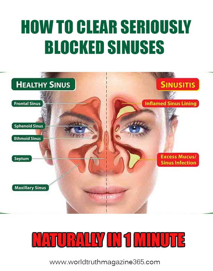 How To Cure A Cough And Stuffy Nose Naturally How To Cure A Cough And Stuffy Nose Naturally