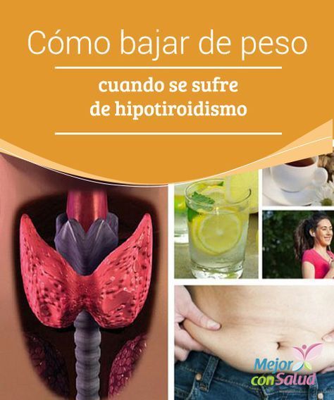 Como bajar de peso padeciendo hipotiroidismo