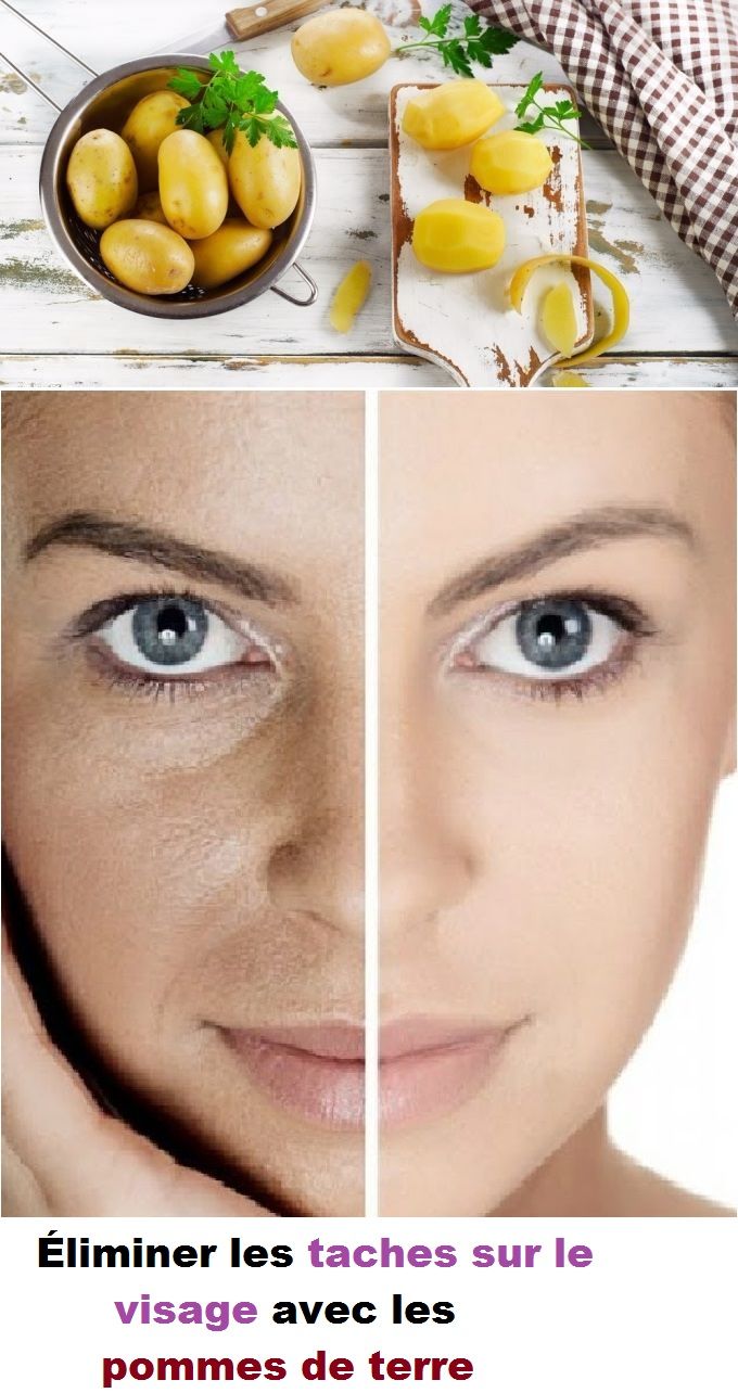 masque visage anti tache masque visage anti tache