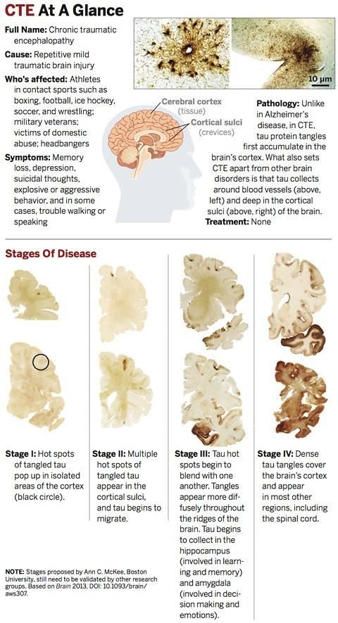How Cte Chronic Traumatic >> The Layperson S Guide To Traumatic Brain Injury Tbi And Chronic How Cte Chronic Traumatic >> The Layperson S Guide To Traumatic Brain Injury Tbi And Chronic