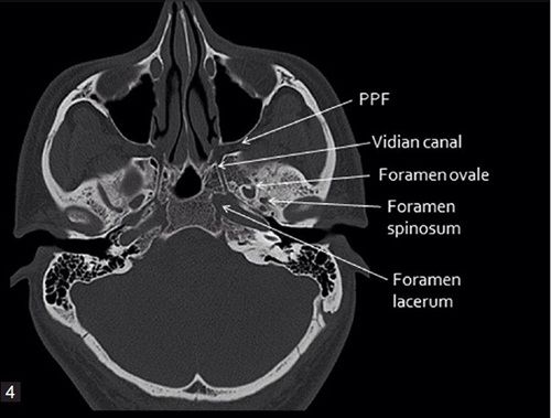 Pin em Dental Anatomy