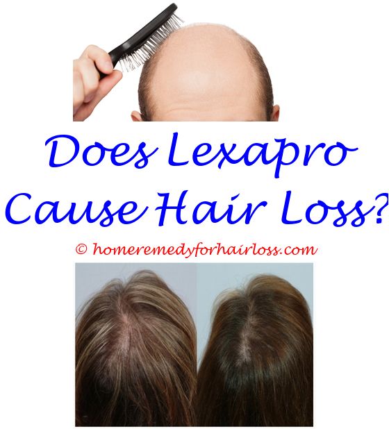 14 best Vitamin D Hair Loss images on Pinterest