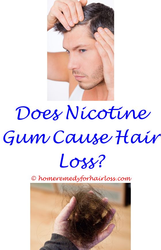 11 best Supplements For Hair Loss images on Pinterest | Fast hair ...