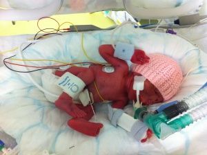 Bebeginiz Kor Kalmasin Rop Muayenesi Cok Onemli Neonatal Care Nicu Neonatal Bebeginiz Kor Kalmasin Rop Muayenesi Cok Onemli Neonatal Care Nicu Neonatal