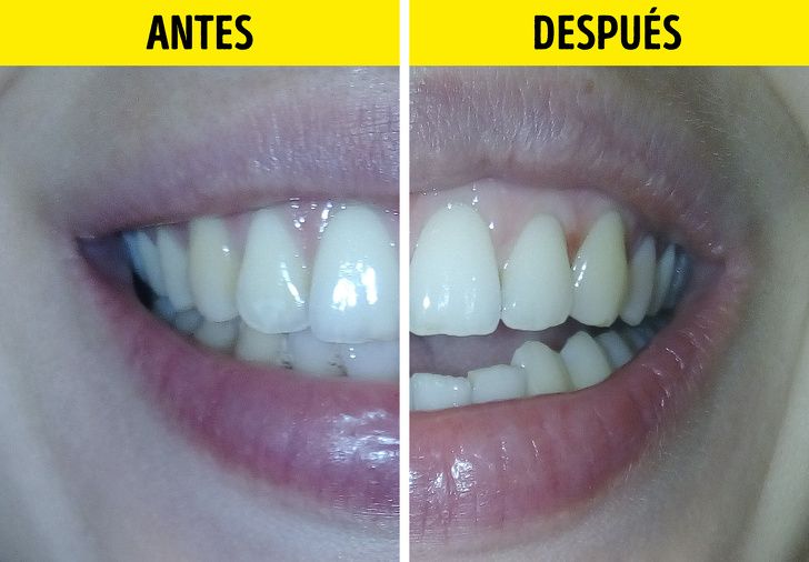 Verificamos 5 Maneras Caseras De Blanquear Los Dientes El Bicarbonato De Sodio Nos Decepcionó Blanquear Dientes Blanquear Dientes Bicarbonato Blanquear Naturalmente Los Dientes