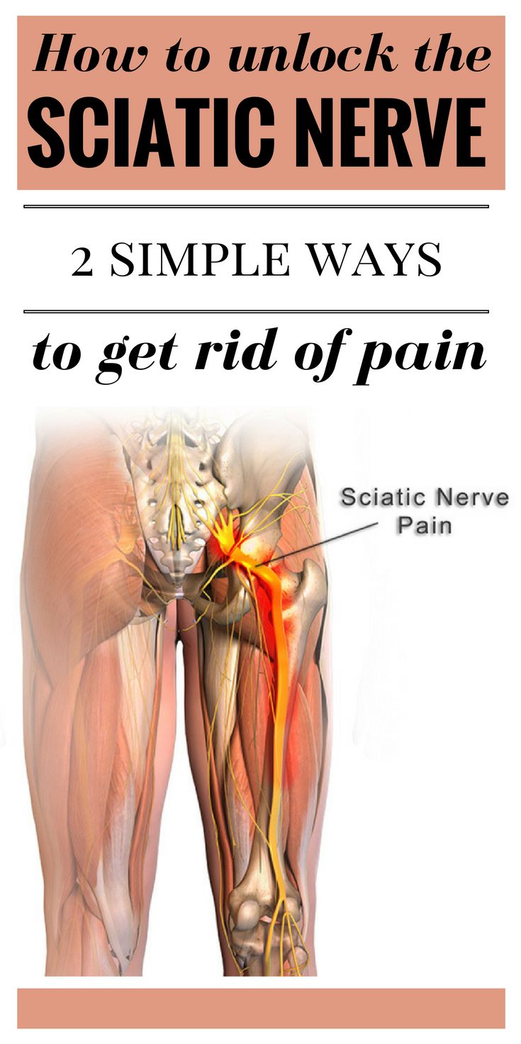 How To Get Rid Of Sciatic Nerve Pain Naturally How To Get Rid Of Sciatic Nerve Pain Naturally