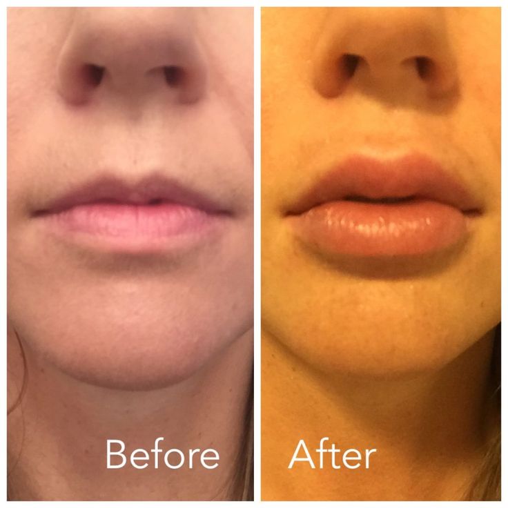Pin on Lips makeup