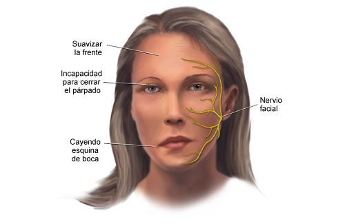Facial muscle weak are Facial muscle weak was