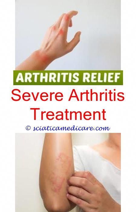 acute rheumatoid arthritis methotrexate for psoriatic arthritis - what medicine ...