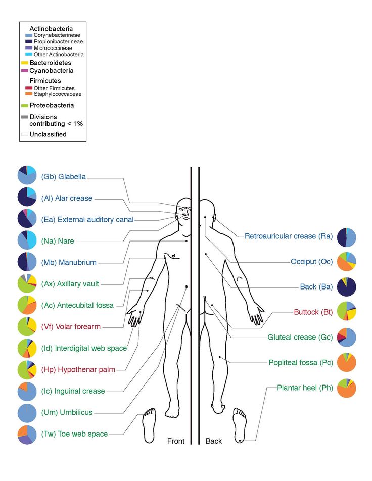 Vaginal yeast infection diagram