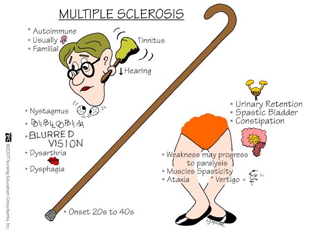Vaginal dilation multiple sclerosis Ways to increase guy masturbation pleasure