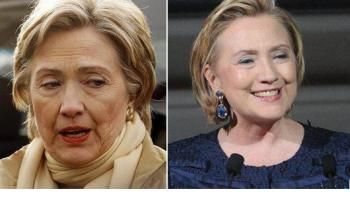 had facial Has surgery obama michele
