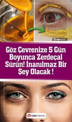 Göz çevrenize 5 gün boyunca zerdeçal sürün! İnanılmaz bir şey olacak !