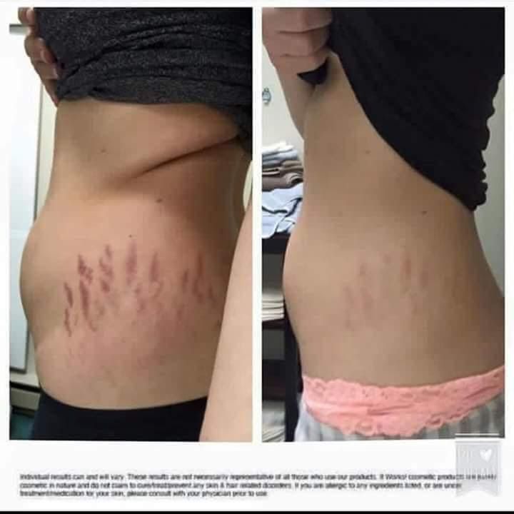 r441 20/10 weight loss program Supposed number r441 20/10 weight loss program example, you typically