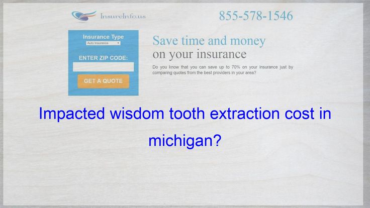 Pin By Auto Company On Best Car Insurance Company Compare Car
